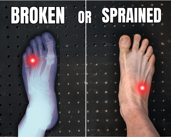Broken or Sprained Foot? How Runners Can Tell the Difference (And Recover Faster)