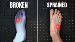 Broken or Sprained Foot? How Runners Can Tell the Difference (And Recover Faster)